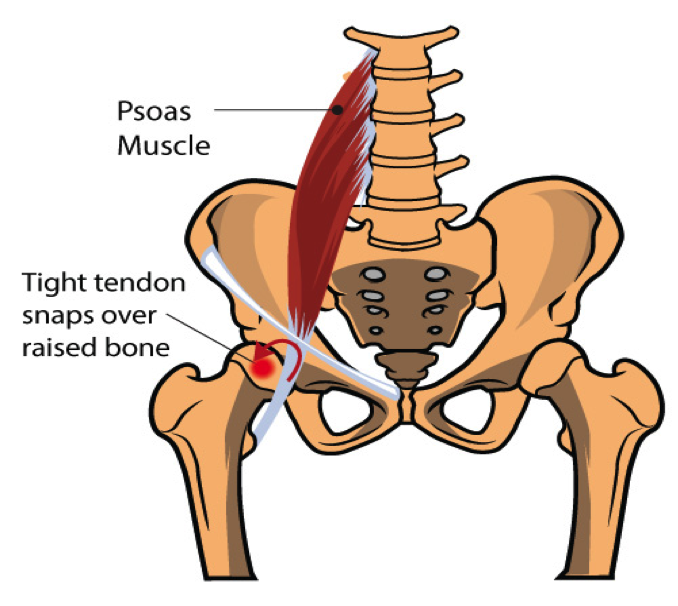 iliopsoas tendon