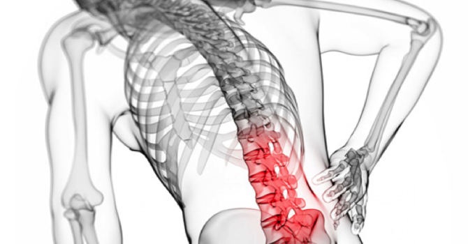 Condition of the Month: Low Back Strain image