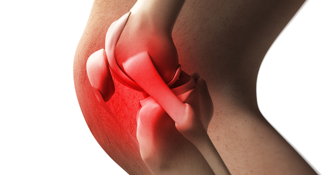 Condition of the Month – Knee Pain image